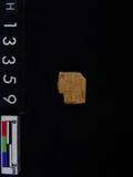 ~²(²G215.0XX)
