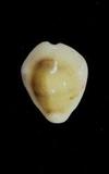 _(Cypraea (Erosaria) moneta)