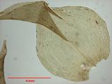 拉丁學名： em Meteoriopsis reclinata (C. Muell.) Fleisch. In Broth. /em 中文名稱：反葉粗蔓蘚