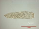 拉丁學名： em Sphagnum angustifolium (C. Jens.) C. Jens. /em 中文名稱：泥炭蘚屬