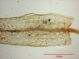 拉丁學名： em Physcomitrium turbinatum (Michx.) Brid. /em 中文名稱：立碗蘚屬