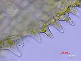 中文種名:刺疣鱗蘚