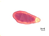 學名:Ichthyaspis ficicola (Takahashi, 1931)