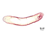 中文種名:蟲形竹盾介殼蟲學名:Kuwanaspis vermiformis (Takahashi, 1931)