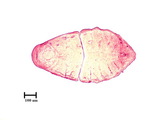 中文種名:側骨副蠣盾介殼蟲學名:Lepidosaphes laterochitinosa Green, 1925