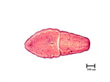 中文種名:側骨副蠣盾介殼蟲學名:Lepidosaphes laterochitinosa Green, 1925