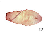 中文種名:鵝卵鼻長蠣盾介殼蟲學名:Lepidosaphes garambiensis Takahashi, 1933