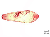 中文種名:白茅棘蠣盾介殼蟲學名:Acanthomytilus imperatae (Kuwana, 1931)