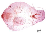 中文種名:高雄蠣盾介殼蟲學名:Lepidosaphes takaoensis Takahashi, 1935