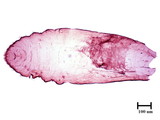 學名:Lepidosaphes sp.