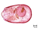 中文種名:臺灣新片盾介殼蟲學名:Neoparlatoria formosana Takahashi, 1931