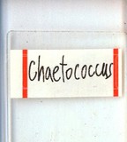中文種名:籜竹粉介殼蟲學名:Chaetococcus bambusae (Maskell, 1893)