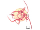 學名:Allomyrmococcus acariformis Takahashi, 1941