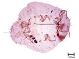 中文種名:野桐臀粉介殼蟲學名:Formicococcus macarangae (Takahashi, 1940)