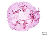 中文種名:野桐臀粉介殼蟲學名:Formicococcus macarangae (Takahashi, 1940)