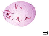 中文種名:樟蟻粉介殼蟲學名:Formicococcus cinnamomi Takahashi, 1928