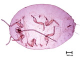 中文種名:樟蟻粉介殼蟲學名:Formicococcus cinnamomi Takahashi, 1928