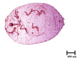 中文種名:樟蟻粉介殼蟲學名:Formicococcus cinnamomi Takahashi, 1928