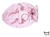 中文種名:樟蟻粉介殼蟲學名:Formicococcus cinnamomi Takahashi, 1928