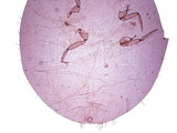 中文種名:芒毛粉介殼蟲學名:Pilococcus miscanthi Takahashi, 1928