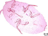 學名:Pseudococcus casuarinae (Takahashi, 1939)