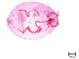 中文種名:知本粉介殼蟲學名:Crisicoccus chiponensis (Takahashi, 1939)