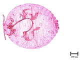 中文種名:知本粉介殼蟲學名:Crisicoccus chiponensis (Takahashi, 1939)