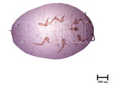 中文種名:柑桔粉介殼蟲學名:Planococcus citri (Risso, 1813)