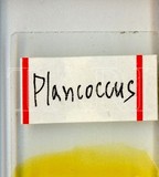 中文種名:柑桔粉介殼蟲學名:Planococcus citri (Risso, 1813)