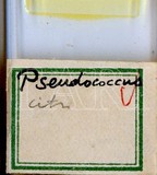 中文種名:柑桔粉介殼蟲學名:Planococcus citri (Risso, 1813)