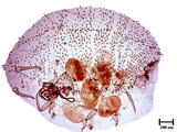 學名:Acanthococcus sutepensis (Takahashi, 1942)