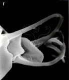 文件名稱:Neopropilus jatrophus Huang, 1992 Genital coverflap, female.