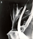 文件名稱:Phyllocoptruta semialatae Huang, 1992~Genital coverflap, female.