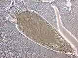 W:Calepitrimerus alnus Huang, 2001 I