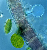 文件名稱:Hyalodiscus 明盤藻屬